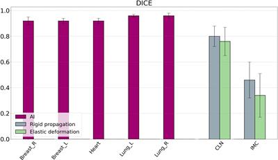 Feasibility study of adaptive radiotherapy with Ethos for breast cancer